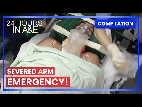 Paramedics Fight to Save Severed Arm 24 Hours in A&E