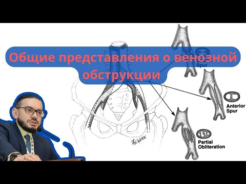 Видеолекция "Общие представления о венозной обструкции" (17.06.2022)