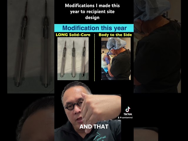 Modifications I made this year to recipient site design