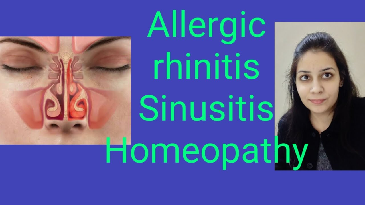 Allergic rhinitis,sinusitis को कैसे ठीक करें )Recurrent coryza Remedy ...
