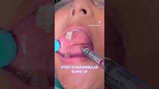 #shorts #shortvideo #short #shortsfeed #viral #viralvideo #edit #explore #fyp #subscribe #video #fy