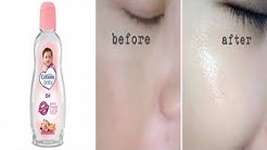 Cara Mudah Memutihkan Dan Mencerahkan Kulit Wajah Hanya 7 Hari Dengan BAby Oil - Durasi: 5.30. 