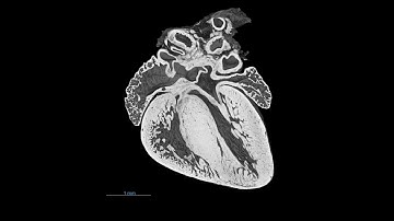 3D Mouse Embryonic Heart Reconstruction | High-Resolution Episcopic Microscopy (HREM)
