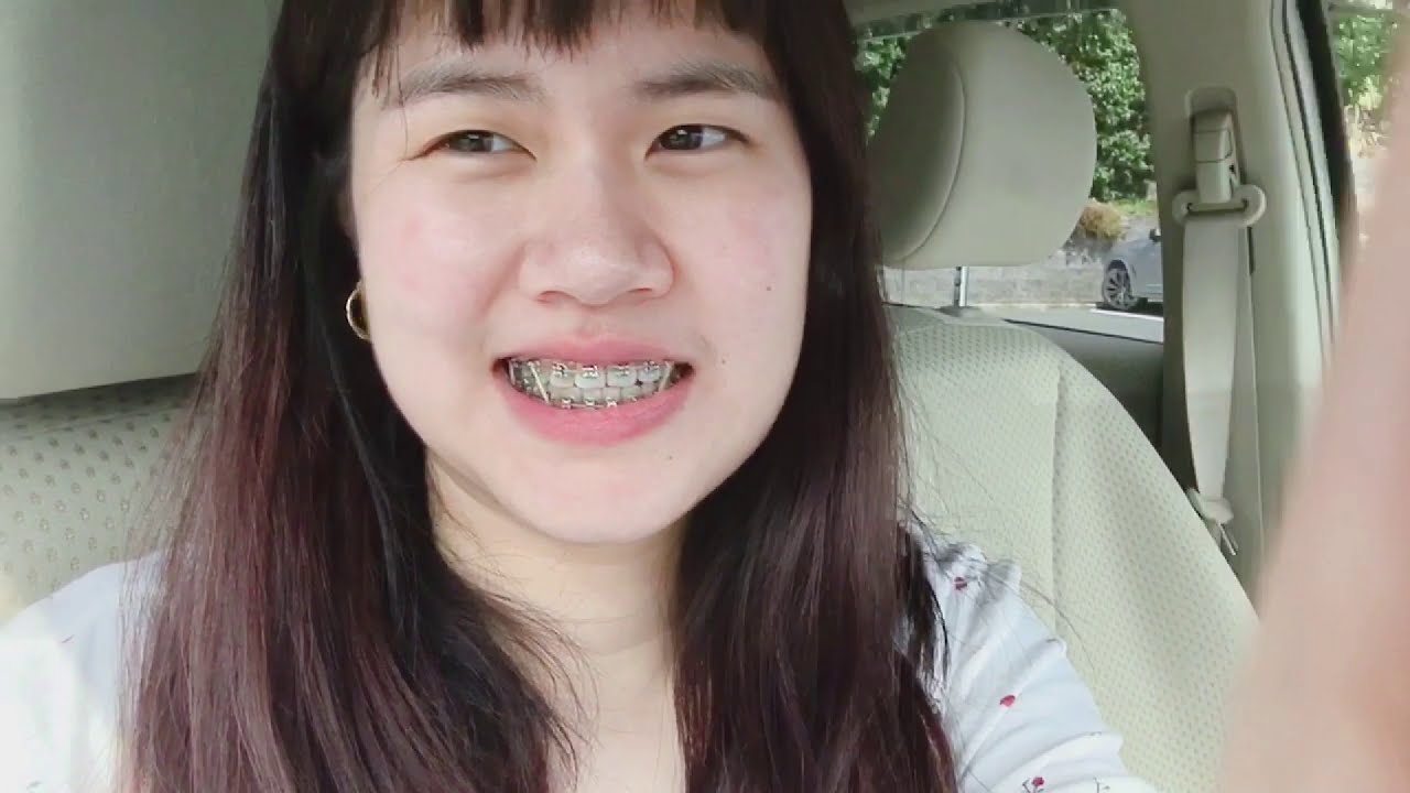My Braces Adjustment Day 4 Having Korean BBQ with fam after visit