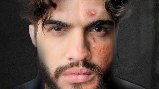 Cuidados com a PELE MASCULINA | Guia de Skincare para Homens