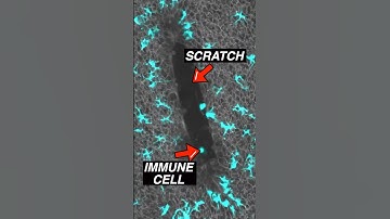 Immune cells responding to a scratch in epidermis #immunity #microscope #science #microbiology