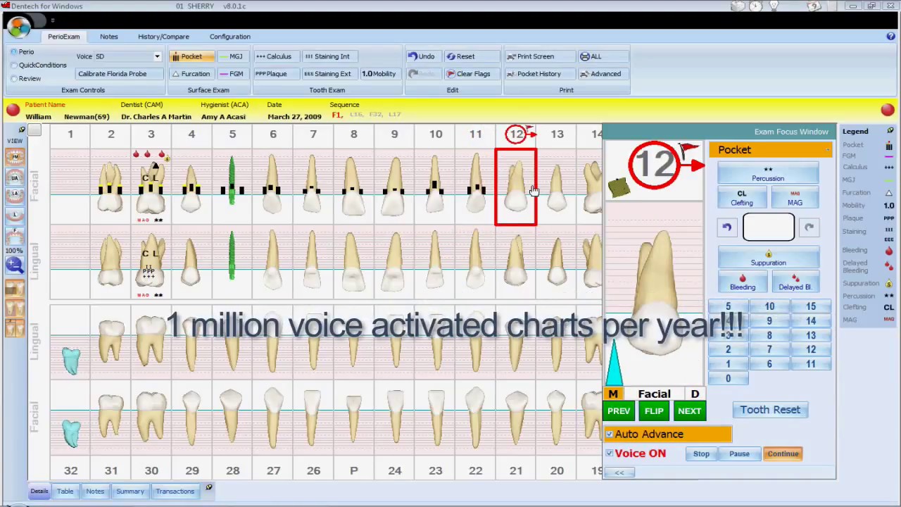 Voice Activated Periodontal Charting