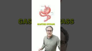 Abdominal Pain from Gastric Bypass #shorts
