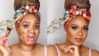 EVERYDAY SOFT NEUTRAL GLAM : PROBLEM SKIN | OMABELLETV screenshot 4