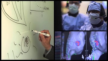 Stanford Doctor Shares Breakthrough Afib Care