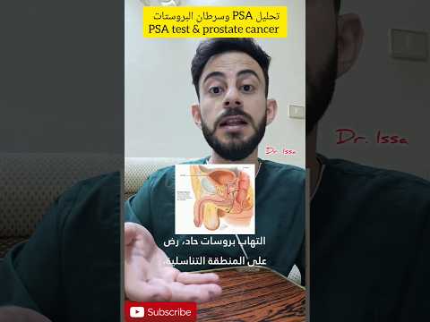 هل ارتفاع بتحليل  يشير حتما لسرطان البروستات 
