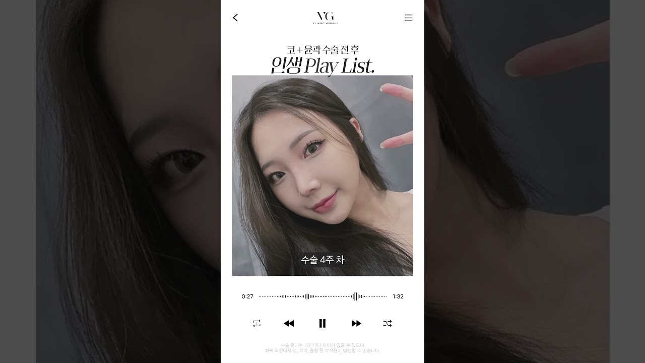 [貝麗古德整形外科診所] 鼻部重修手術+輪廓手術後播放列表公開🎶