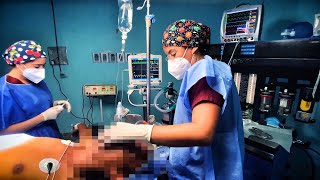 Un Día en Anestesiología - Videolaringoscopia | Mentes Médicas