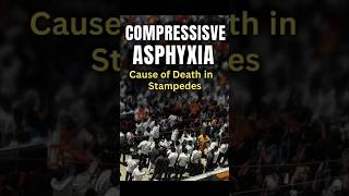 Full Compressive Asphyxia Update