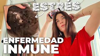 TENGO UNA ENFERMEDAD INMUNE QUE ME HA APARECIDO POR EL ESTRÉS! UN #vlog MUY PERSONAL @BonbonReich