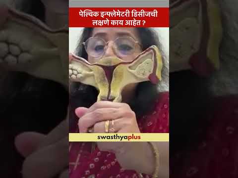 पेल्विक इन्फ्लेमेटरी डिसीजची लक्षणे काय आहेत? | Symptoms of Pelvic Infection | Dr Rekha Thote