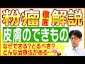 【手術後の傷跡の悩みも安心！】きずときずあと専門のクリニックだから可能な粉瘤(アテローマ)の治療法とは！？