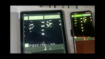 IPv6 neither firewalled nor NATed, and Morse Code