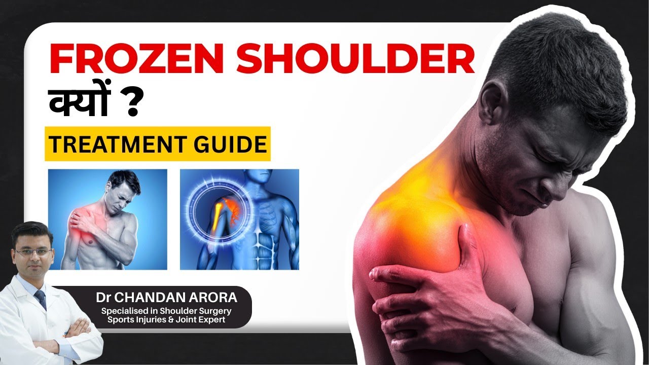 Frozen Shoulder सच में होता है? 90% लोग इसका गलत इलाज कर रहे हैं!