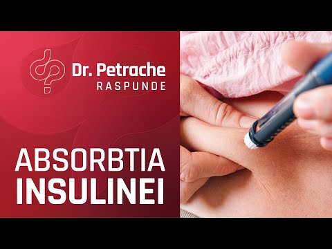 Video: Ghid Pentru Discuții Despre Medic: Comutarea Insulinei Cu Acțiune Lungă