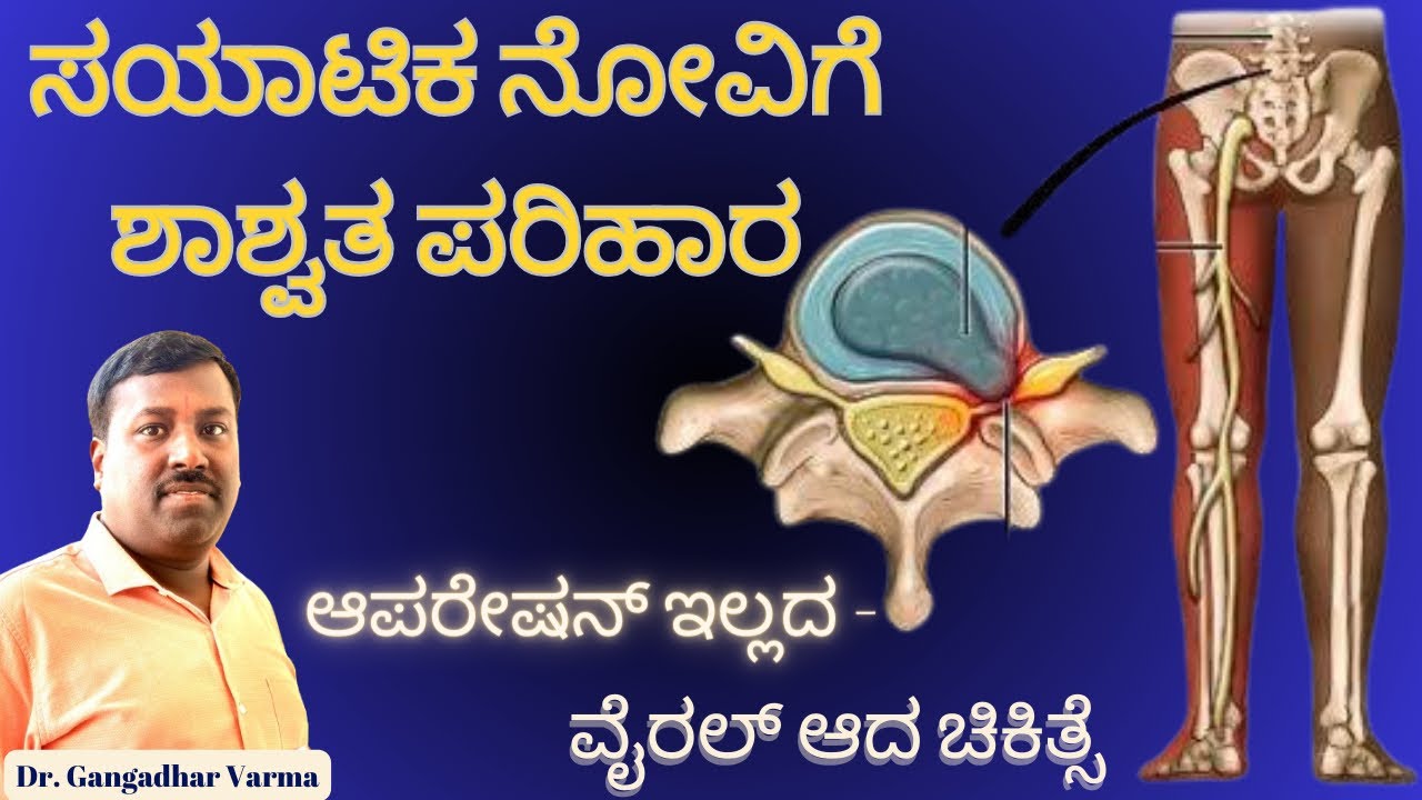 ಸಯಾಟಿಕ ನೋವಿಗೆ ಶಾಶ್ವತ ಪರಿಹಾರ | Dr. Gangadhar Varma | Sciatica | Permanent relief for Sciatica pain