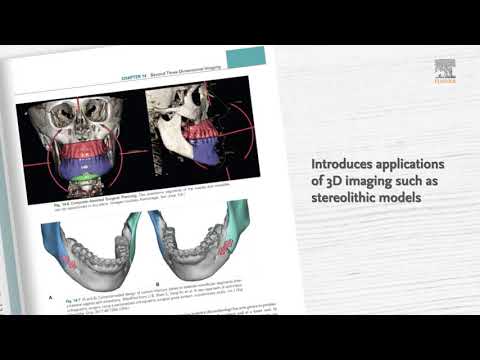 White and Pharoah's Oral Radiology: Principles and Interpretation: Second South Asia Edition