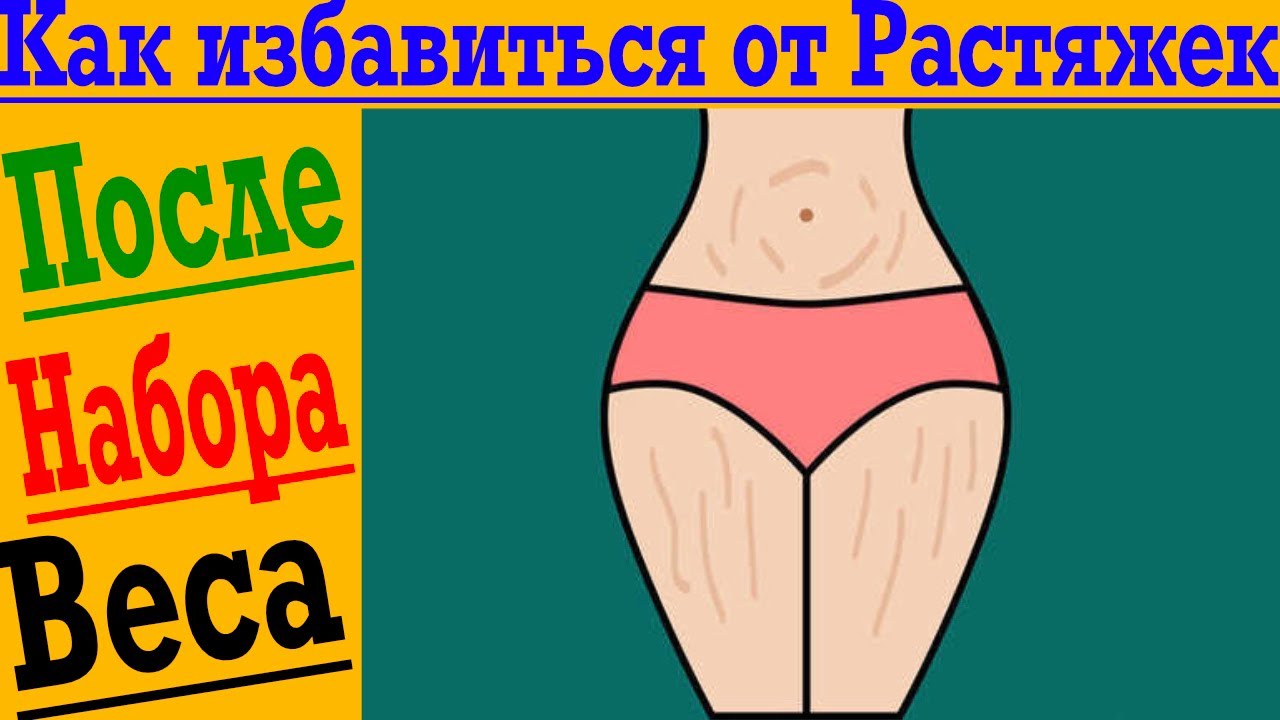 Как избавиться от растяжек на коже?! - YouTube