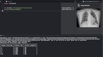 Create ML Image Classification for Pneumonia Detection