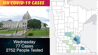 Number COVID-19 Cases In Minnesota Jumps To 77