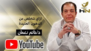 هل اللى بيعملوا دايت وبيلعبوا رياضة وبيأخذوا أدوية وعندهم سموم هيخسوا .MASRY