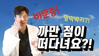 까만 점이 떠다녀요😣 비문증✨ 안과 망막검사와 치료법은❓❗ [진짜 안과] [성모 진안과]