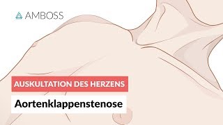 Aortenklappenstenose -- Auskultation des Herzens -- Folge 1 screenshot 3