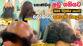 Ladies Baldness Solution|human hair Toppers|ladies Bald Solution|Srilanka | Ushine | Kiribathgoda|