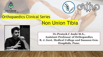 NON UNION - TIBIA | CASE PRESENTATION | DR.PRATEEK C JOSHI M.D., | MEDUSANE