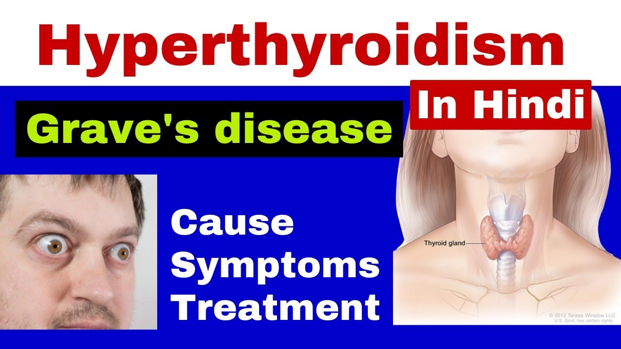 Hyperthyroidism in Hindi | Causes, Symptoms & Treatment | Endocrine Disorder | GNM 2nd Year