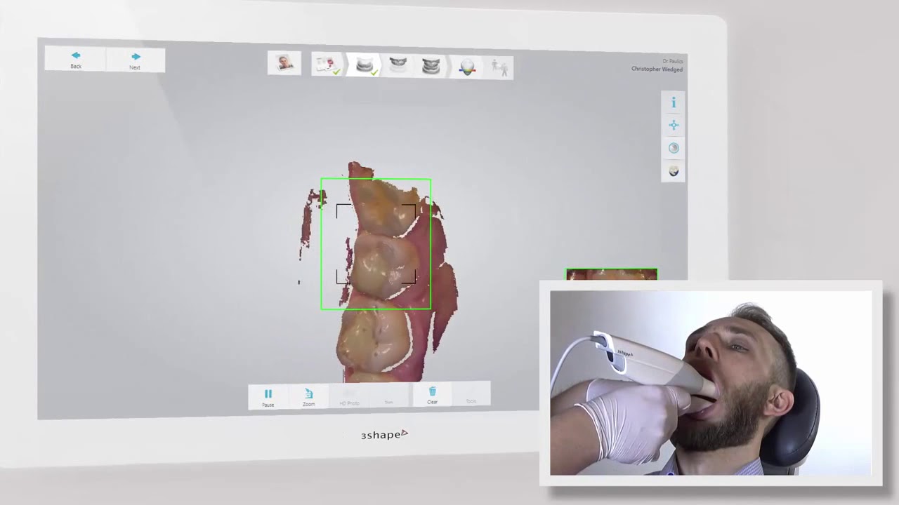 3Shape TRIOS Scan Strategy - Quadrant(Korean)