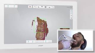3Shape TRIOS Scan Strategy - Quadrant(Korean)