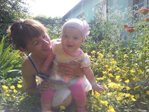 Синяк на лбу. Софи и ее первый синячок. Синяк на лбу. Софи и ее первый синячок.
