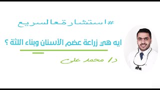 ماهي زراعة العظم للاسنان ؟ وزراعة اللثة ؟ screenshot 4