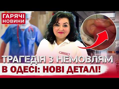 СКАНДАЛ В ОДЕСІ! НЕМОВЛЯТІ ВІДРІЗАЛИ ЧАСТИНУ ПАЛЬЧИКА: гендиректорка лікарні розповіла свою версію