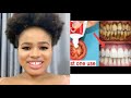 LIVE DEMO TEETH WHITENING AT HOME