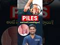 పైల్స్ ఎందుకు వస్తాయి? | Piles Reasons and Treatment | Treatment Range Hospital | #shorts #piles