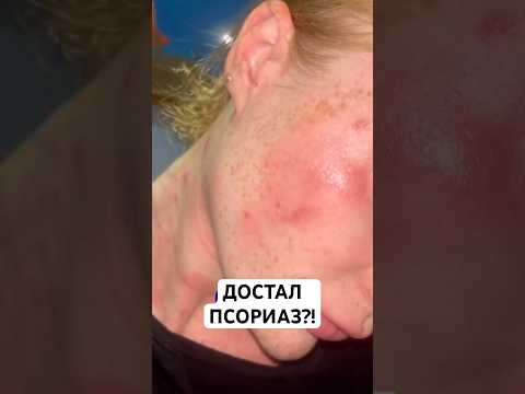 Купить Фледокс в немецкой аптеке: просто и быстро