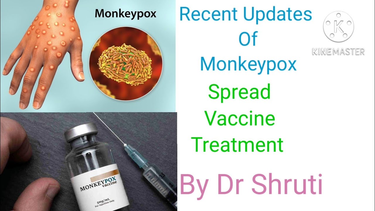 Recent Updates of Monkeypox : CDC Guidelines, मंकीपाक्स  वैक्सीन 