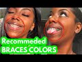 Choose THESE COLORS on your next braces appointment!
