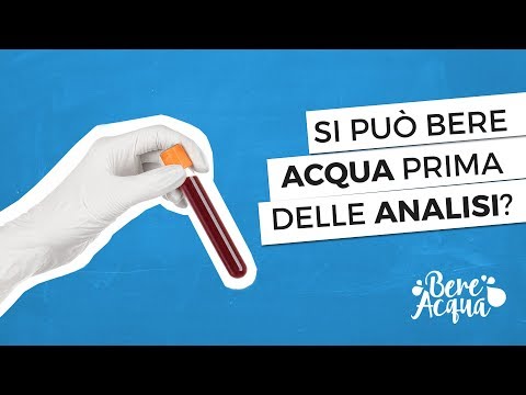 Metodi di Pagamento e Tempistiche Reali