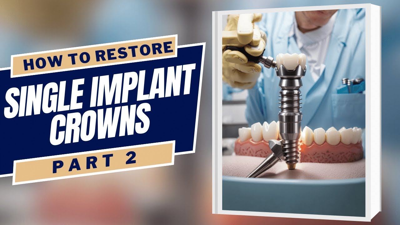 An Idiot's Guide to Restoring Single Implant Crowns Part 2 - PDP157 ...