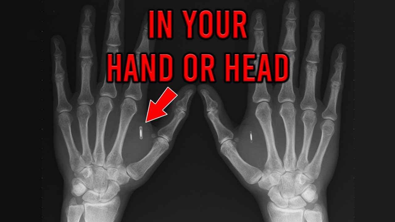 Mark of the Beast Update 2022 | We're Moving Towards the Book of Revelation 