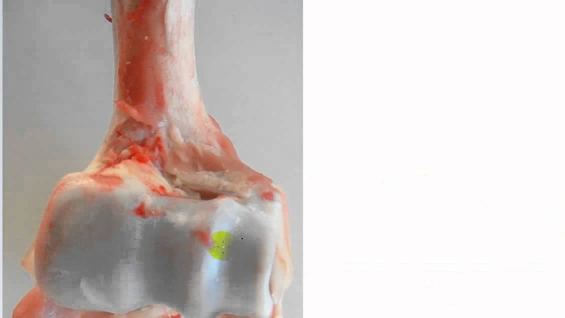 general anatomy  8 - cartilage - by dr sameh ghazy