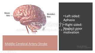 Syphilis; neurosyphilis